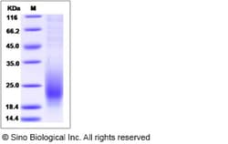 Sino Biological Recombinant Mouse CD53 Protein (aa 107-181, His Tag), Quantity: