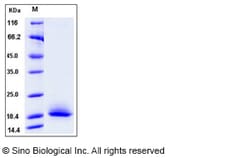 Sino Biological Recombinant Mouse CD59a Protein (His Tag), HPLC-verified,