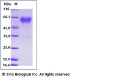 Sino Biological Mouse CD68 Protein (His Tag) 100ug, Quantity: Each of 1