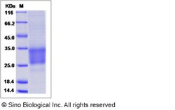 Sino Biological Recombinant Mouse CD69 Protein (ECD, His Tag), Quantity: