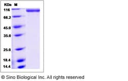 Sino Biological Mouse E-Selectin / CD62e / SELE Protein (Fc Tag) 100ug,