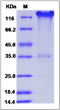 Sino Biological Mouse SELP / selectin P / P-selectin Protein (Fc Tag) 100ug,