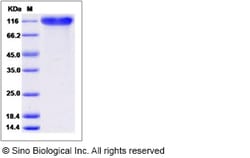 Sino Biological Recombinant Mouse P-Selectin/CD62P Protein (His Tag), HPLC-verified
