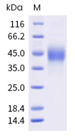 Sino Biological Mouse CD74 Protein 1MG (Sino Biological), Quantity: Each
