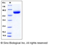 Sino Biological Recombinant Mouse ST6GAL1 Protein (His Tag), HPLC-verified,