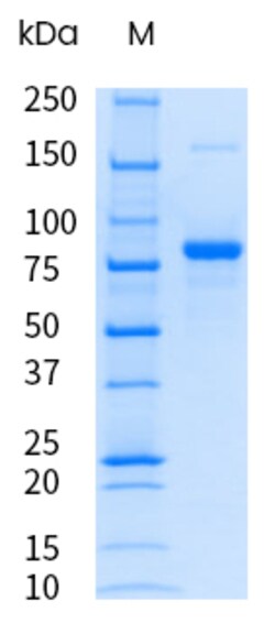 Sino Biological&nbsp;Recombinant Mouse Transferrin Receptor/TFR1/CD71 Protein (ECD, His Tag), Endotoxin-Free