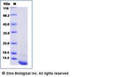 Sino Biological Recombinant Mouse CD81 Protein (His Tag), Quantity: Each