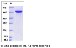 Sino Biological Recombinant Mouse Lactoferrin/LTF Protein (His Tag), HPLC-verified,