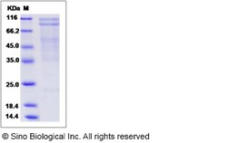 Sino Biological Mouse N-Cadherin / CD325 / CDH2 Protein 100ug, Quantity: