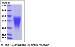 Sino Biological Mouse LIF Protein 20ug, Quantity: Each of 1