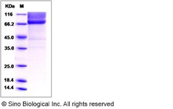Sino Biological Recombinant Mouse Biglycan Protein (hFc Tag), HPLC-verified,