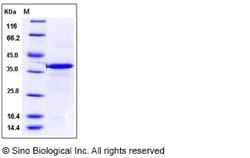 Sino Biological Recombinant Mouse Carbonic Anhydrase 8/CA8 Protein (His