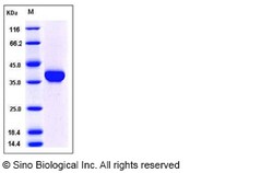 Sino Biological Recombinant Mouse Carbonic Anhydrase X Protein (His Tag),