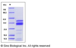 Sino Biological Mouse Cathepsin S / CTSS Protein (His Tag) 50ug, Quantity: