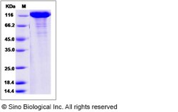 Sino Biological Recombinant Mouse Vinculin Protein (His Tag), Quantity: