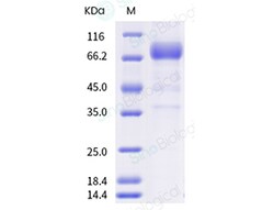 Sino Biological Protein Mouse IL2RB 100ug, Quantity: Each of 1