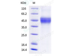 Sino Biological Recombinant Mouse IL-2R beta/CD122 Protein (His Tag), HPLC-verified,