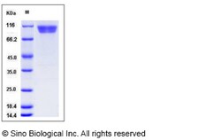 Sino Biological Recombinant Mouse CD146/MCAM Protein (His Tag), Quantity: