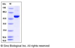 Sino Biological Recombinant Mouse DOPA Decarboxylase/DDC Protein (His Tag),