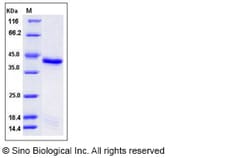 Sino Biological Recombinant Mouse TC-PTP/PTPN2 Protein (aa 2-314, His Tag),