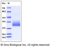 Sino Biological Recombinant Mouse Klrb1a Protein (His Tag), Quantity: Each
