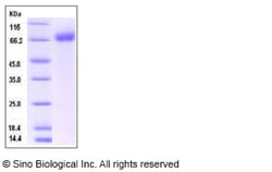 Sino Biological Recombinant Mouse IL1R1 Protein (hFc Tag), Quantity: Each