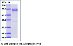 Sino Biological Recombinant Mouse OX40/TNFRSF4 Protein (rFc Tag), Quantity: