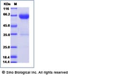 Sino Biological Mouse CD137 / 4-1BB / TNFRSF9 Protein (soluble form, rFc