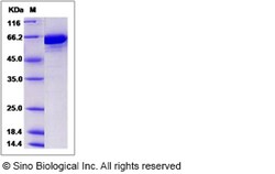 Sino Biological Recombinant Mouse Transferrin Protein (His Tag), Quantity: