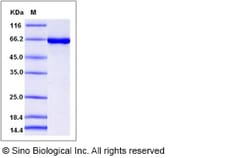 Sino Biological Recombinant Mouse CK2 alpha/CSNK2A1 Protein (His & GST