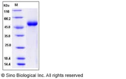 Sino Biological Recombinant Mouse DDR1 Protein (His Tag), HPLC-verified,