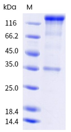 Sino Biological Mouse L1CAM Protein 1MG (Sino Biological), Quantity: Each