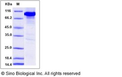 Sino Biological Mouse CAMK4 / CaMKIV Protein (His & GST Tag) 50ug, Quantity: