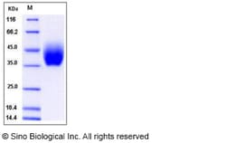 Sino Biological Recombinant Mouse IL-10RB/IL-10R beta Protein (His Tag),