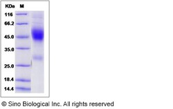 Sino Biological Recombinant Mouse NXPH1 Protein (His Tag), Quantity: Each