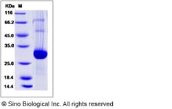 Sino Biological Recombinant Mouse GLIPR1 Protein (His Tag), Quantity: Each