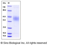 Sino Biological Recombinant Mouse EPCR Protein (His Tag), HPLC-verified,