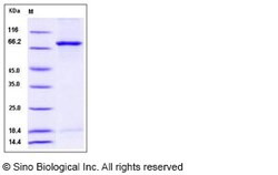 Sino Biological Recombinant Mouse NEK3 Protein (His & GST Tag), Quantity: