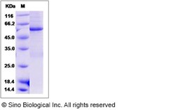Sino Biological Mouse CDC2 Kinase / CDK1 Protein (His & GST Tag) 50ug,