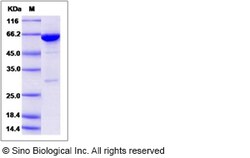 Sino Biological Recombinant Mouse SHP-1 Protein (aa 207-597, His & GST