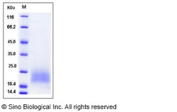 Sino Biological Recombinant Mouse BAMBI Protein (His Tag), Quantity: Each
