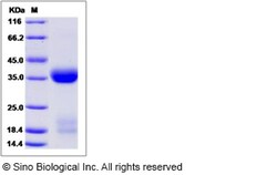 Sino Biological Mouse KLK1 / Kallikrein 1 Protein (His Tag) 50ug, Quantity: