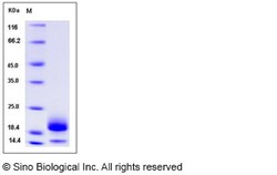 Sino Biological Mouse Cystatin E / CST6 Protein (His Tag) 20ug, Quantity: