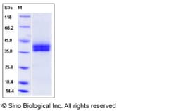 Sino Biological Recombinant Mouse Kallikrein 11 Protein (His Tag), Quantity: