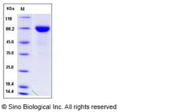 Sino Biological Recombinant Mouse TROP-2 Protein (hFc Tag), Quantity: Each