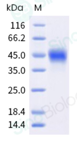 Sino Biological Recombinant Mouse TROP-2 Protein (His Tag), HPLC-verified,