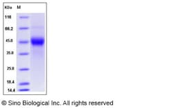 Sino Biological Mouse TROP2 / TACSTD2 Protein (His Tag) 100ug, Quantity: