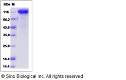 Sino Biological Recombinant Mouse Nicastrin Protein (hFc Tag), Quantity: