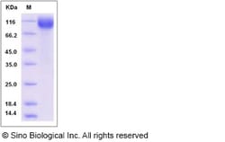Sino Biological Recombinant Mouse Nicastrin Protein (His Tag), Quantity: