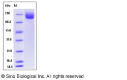 Sino Biological Recombinant Mouse NAALADL1 Protein (His Tag), Quantity: